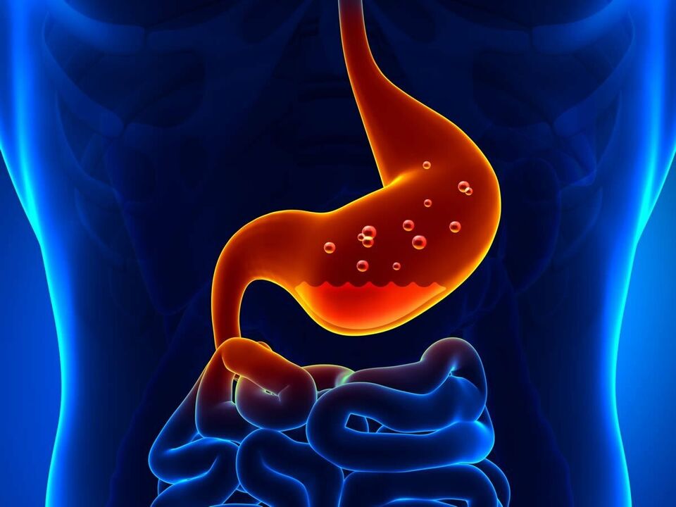 Gastrīts ir kuņģa iekaisuma slimība, kurai nepieciešama diēta